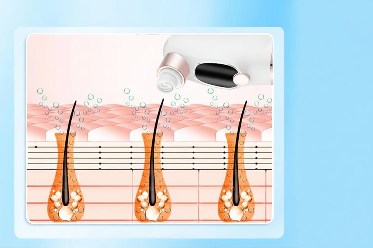 Blackhead Remover Vacuum - L&L Shop